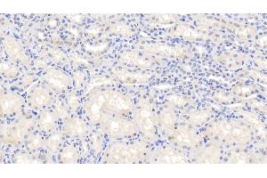 Detection of IL1b in Caprine Kidney Tissue using Polyclonal Antibody to Interleukin 1 Beta (IL1b) (IL-1 beta 抗体  (AA 1-266))