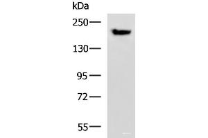 Western blot analysis of Mouse brain tissue lysate using PDS5B Polyclonal Antibody at dilution of 1:800 (PDS5B 抗体)