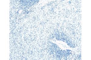 (ABIN184738) Negative Control showing staining of paraffin embedded Human Spleen, with no primary antibody.