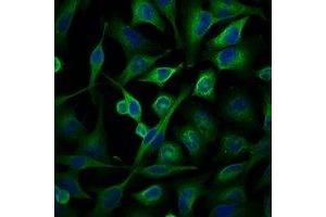 Immunofluorescent analysis of Alpha-tubulin staining in Hela cells. (alpha Tubulin 抗体)