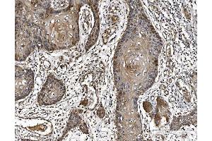 IHC analysis of PARK7/DJ1 using anti-PARK7/DJ1 antibody (ABIN7600468). (PARK7/DJ1 抗体  (AA 2-189))