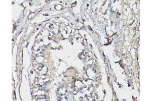Immunohistochemistry of paraffin-embedded Human breast using BAP1 Polyclonal Antibody at dilution of 1:150 (40x lens). (BAP1 抗体)