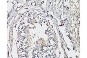Immunohistochemistry of paraffin-embedded Human breast using BAP1 Polyclonal Antibody at dilution of 1:150 (40x lens). (BAP1 抗体)