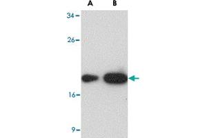 Western blot analysis of (A) 25 and (B) 125 ng of LY96 recombinant protein with LY96 monoclonal antibody, clone 1A2E3  at 1 ug/mL .