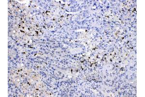 Immunohistochemistry (IHC) image for anti-Neural Precursor Cell Expressed, Developmentally Down-Regulated 8 (NEDD8) (AA 20-60), (Middle Region) antibody (ABIN4886679)
