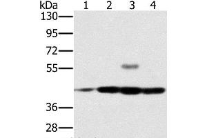 Western Blot analysis of Jurkat, Raji, K562 and hela cell using PAICS Polyclonal Antibody at dilution of 1:400 (PAICS 抗体)
