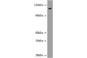 Image no. 1 for anti-Luteinizing Hormone/Choriogonadotropin Receptor (LHCGR) antibody (ABIN2937954) (LHCGR 抗体)