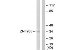 Western blot analysis of extracts from HeLa cells, using ZNF265 Antibody. (ZNF265 抗体  (AA 106-155))