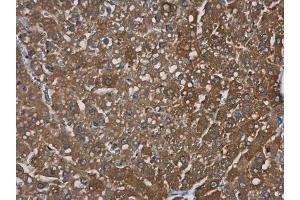Immunohistochemistry (IHC) image for anti-Transient Receptor Potential Cation Channel, Subfamily M, Member 2 (TRPM2) (N-Term) antibody (ABIN2856853)