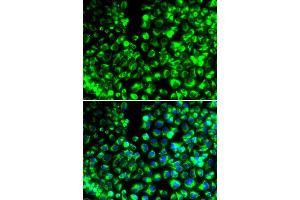 Immunofluorescence analysis of HeLa cell using CALU antibody. (CALU 抗体)
