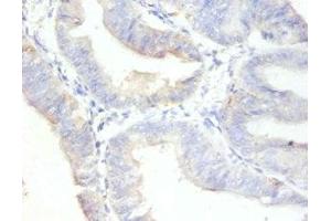 Immunohistochemistry (IHC) image for anti-Antigen Identified By Monoclonal Antibody Ki-67 (MKI67) (AA 3120-3256) antibody (ABIN7164742)