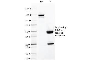 SDS-PAGE Analysis Purified CD103 Mouse Monoclonal Antibody (ITGAE/2063). (CD103 抗体)