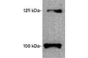 Image no. 1 for anti-Leptin Receptor (LEPR) (AA 577-594) antibody (ABIN187816) (Leptin Receptor 抗体  (AA 577-594))