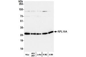 anti-Ribosomal Protein L10a (RPL10A) (AA 50-100) antibody