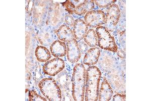 Immunohistochemistry of paraffin-embedded rat kidney using Alpha Fodrin Rabbit mAb (ABIN7270518) at dilution of 1:100 (40x lens). (SPTAN1 抗体)