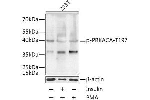 Western blot analysis of extracts of 293T cells, using Phospho-PKA C-alpha (PRKACA)-T197 antibody (ABIN6135290, ABIN6136202, ABIN6136203 and ABIN6225582) at 1:1000 dilution. (PRKACA 抗体  (pThr197))