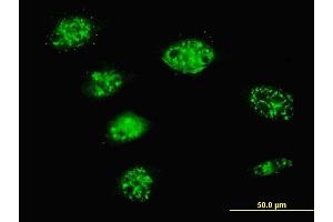 Immunofluorescence of monoclonal antibody to SMARCD3 on HeLa cell. (SMARCD3 抗体  (AA 385-483))