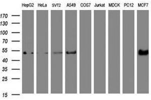 Image no. 8 for anti-Selenium Binding Protein 1 (SELENBP1) antibody (ABIN1500860) (SELENBP1 抗体)