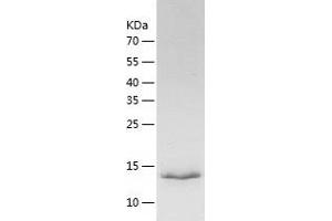 Western Blotting (WB) image for Nescient Helix Loop Helix 2 (NHLH2) (AA 1-135) protein (His tag) (ABIN7124133) (NHLH2 Protein (AA 1-135) (His tag))