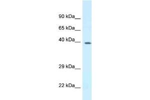 Western Blotting (WB) image for anti-D4, Zinc and Double PHD Fingers, Family 3 (DPF3) (N-Term) antibody (ABIN2780850)