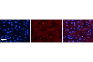 Immunohistochemistry (IHC) image for anti-Zinc Finger, CCCH-Type with G Patch Domain (ZGPAT) (N-Term) antibody (ABIN2775532)