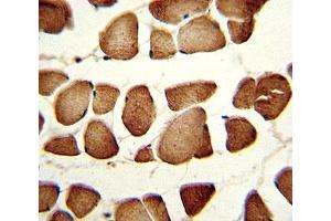 Immunohistochemistry (IHC) image for anti-Nicotinamide phosphoribosyltransferase (NAMPT) (AA 400-426) antibody (ABIN3031997)