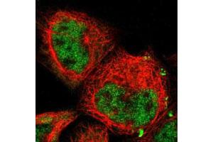 Immunofluorescent staining of A-431 cells with COPS5 polyclonal antibody  (Green) shows positivity in nucleus but excluded from the nucleoli. (COPS5 抗体)