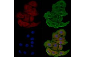 ABIN6259034 and ABIN6275060 staining Hela cells by IF/ICC. (DHODH 抗体  (Internal Region))