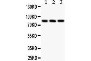 Western Blotting (WB) image for anti-Protein Phosphatase 3, Catalytic Subunit, alpha Isoform (PPP3CA) (AA 488-521), (C-Term) antibody (ABIN3042493)