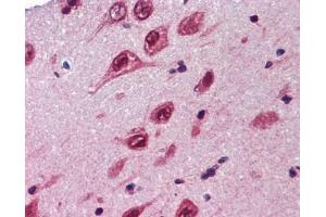 Ubiquilin 1 antibody was used for immunohistochemistry at a concentration of 4-8 ug/ml. (Ubiquilin 1 抗体  (Middle Region))