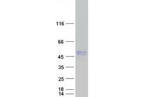Western Blotting (WB) image for Pyruvate Dehydrogenase (Lipoamide) alpha 1 (PDHA1) protein (Myc-DYKDDDDK Tag) (ABIN2728547)