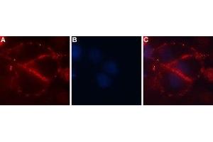 Immunocytochemistry (ICC) image for anti-Calcium Channel, Voltage-Dependent, alpha 2/delta Subunit 4 (CACNA2D4) (AA 881-896), (Extracellular) antibody (ABIN7043016)