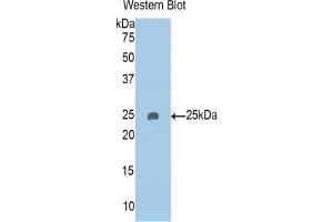 Detection of Recombinant PAPPA2, Human using Polyclonal Antibody to Pappalysin 2 (PAPPA2) (PAPPA2 抗体  (AA 888-1093))