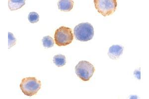 Immunocytochemistry of BMF in HeLa cells with BMF polyclonal antibody  at 10 ug/mL . (BMF 抗体  (N-Term))