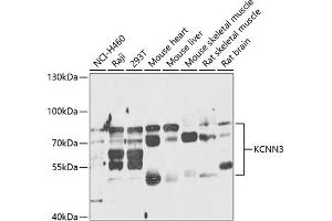 Western blot analysis of extracts of various cell lines, using KCNN3 antibody (ABIN6131839, ABIN6142768, ABIN6142770 and ABIN6218217) at 1:1000 dilution. (KCNN3 抗体  (AA 237-426))