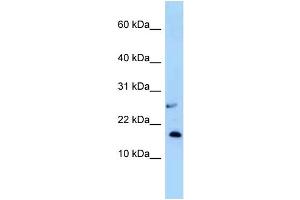 Western Blotting (WB) image for anti-Nudix (Nucleoside Diphosphate Linked Moiety X)-Type Motif 15 (NUDT15) (N-Term) antibody (ABIN2783521)