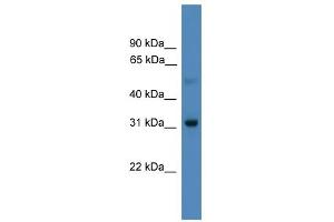 WB Suggested Anti-LBX1 Antibody Titration:  0. (Lbx1 抗体  (N-Term))