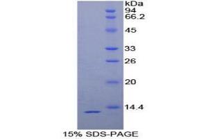 SDS-PAGE (SDS) image for Plasminogen Activator, Urokinase Receptor (PLAUR) (AA 123-216) protein (His tag) (ABIN1171122) (PLAUR Protein (AA 123-216) (His tag))