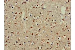 Immunohistochemistry of paraffin-embedded human brain tissue using ABIN7147247 at dilution of 1:100 (CADM3 抗体  (AA 140-328))