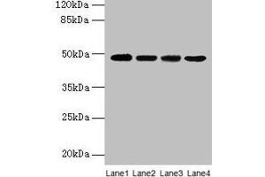 Western blot All lanes: INHBA antibody at 2 μg/mL Lane 1: Hela whole cell lysate Lane 2: HepG2 whole cell lysate Lane 3: A549 whole cell lysate Lane 4: MCF-7 whole cell lysate Secondary Goat polyclonal to rabbit IgG at 1/10000 dilution Predicted band size: 48 kDa Observed band size: 48 kDa (INHBA 抗体  (AA 311-426))