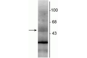Western blot of rat hippocampal lysate showing specific immunolabeling of the ~48 kDa RXR-β protein. (Retinoid X Receptor beta 抗体)