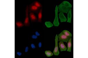 ABIN6255665 and ABIN6268972 staining Hela cells(30 min of UV treatment) by IF/ICC.