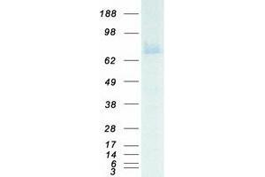 Western Blotting (WB) image for Glucuronidase, beta (GUSB) protein (Myc-DYKDDDDK Tag) (ABIN2715246)
