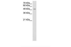 Image no. 2 for anti-Monocarboxylate Transporter 3 (MCT3) (AA 251-300) antibody (ABIN205015) (MCT3 抗体  (AA 251-300))