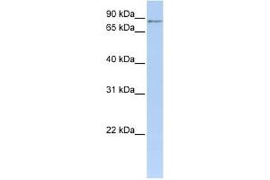MTO1 antibody used at 1 ug/ml to detect target protein. (MTO1 抗体)