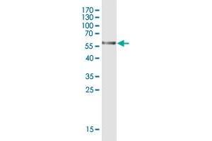 Western Blot detection against Immunogen (60. (GLYATL2 抗体  (AA 1-294))