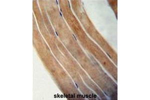 Immunohistochemistry (Paraffin-embedded Sections) (IHC (p)) image for anti-Elongation Factor Tu GTP Binding Domain Containing 1 (EFTUD1) (AA 1069-1098), (C-Term) antibody (ABIN952035)