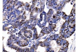 IHC analysis of p57 Kip2/CDKN1C using anti-p57 Kip2/CDKN1C antibody (ABIN7603232). (CDKN1C 抗体  (N-Term))