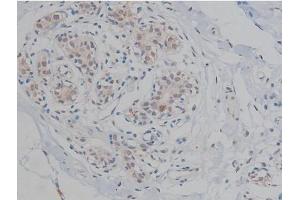 ABIN6267359 at 1/200 staining Human heart tissue sections by IHC-P. (MAPT 抗体  (pThr231))