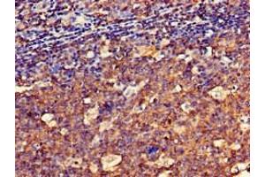 Immunohistochemistry of paraffin-embedded human tonsil tissue using ABIN7148581 at dilution of 1:100 (SPRR1A 抗体  (AA 8-72))